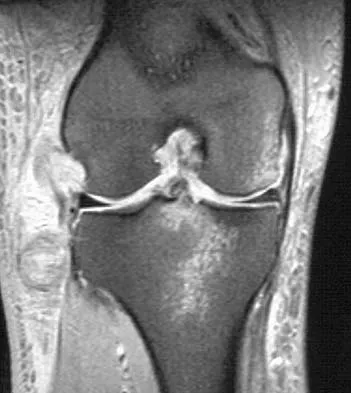General Orthopedics Board Review 2026: High-Yield MCQs (Set 8) - Figure 25