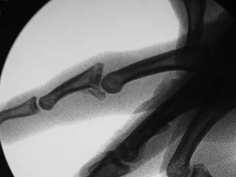 General Orthopedics Board Review 2026: High-Yield MCQs (Set 8) - Figure 32