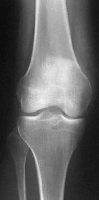 General Orthopedics Board Review 2026: High-Yield MCQs (Set 8) - Figure 38