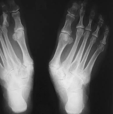 General Orthopedics Board Review 2026: High-Yield MCQs (Set 8) - Figure 44