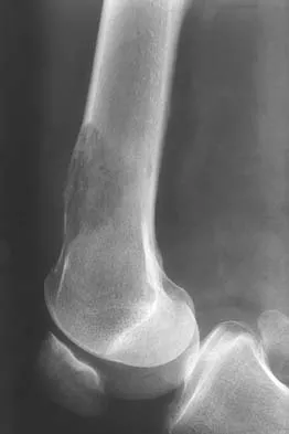 Click to enlarge General Orthopedics Board Review 2026: High-Yield MCQs (Set 8) - Figure 47