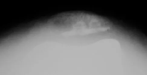 General Orthopedics Board Review 2026: High-Yield MCQs (Set 8) - Figure 5