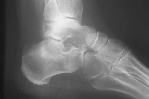 Click to enlarge General Orthopedics Board Review 2026: High-Yield MCQs (Set 8) - Figure 60