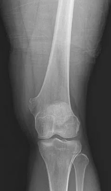 General Orthopedics Board Review 2026: High-Yield MCQs (Set 8) - Figure 65