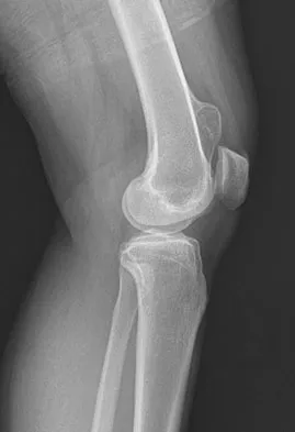 General Orthopedics Board Review 2026: High-Yield MCQs (Set 8) - Figure 66