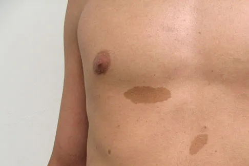 General Orthopedics Board Review 2026: High-Yield MCQs (Set 8) - Figure 70