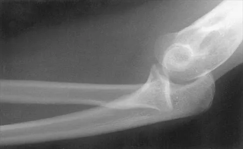 General Orthopedics Board Review 2026: High-Yield MCQs (Set 8) - Figure 76