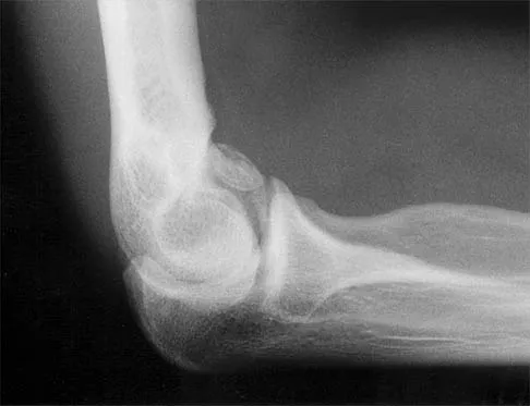 General Orthopedics Board Review 2026: High-Yield MCQs (Set 8) - Figure 8