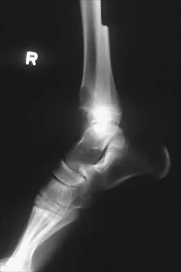 General Orthopedics Board Review 2026: High-Yield MCQs (Set 8) - Figure 85