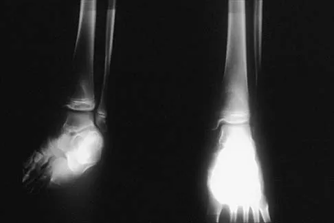 General Orthopedics Board Review 2026: High-Yield MCQs (Set 8) - Figure 86
