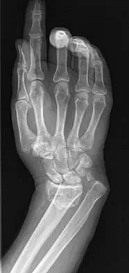 General Orthopedics Board Review 2026: High-Yield MCQs (Set 8) - Figure 93