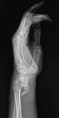 General Orthopedics Board Review 2026: High-Yield MCQs (Set 8) - Figure 94