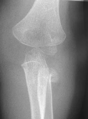 General Orthopedics 2026 Practice Questions: Set 9 (Solved) - Figure 103