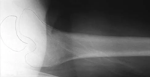 General Orthopedics 2026 Practice Questions: Set 9 (Solved) - Figure 15