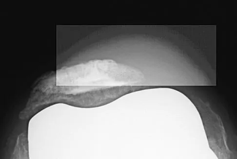 General Orthopedics 2026 Practice Questions: Set 9 (Solved) - Figure 18