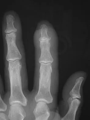 General Orthopedics 2026 Practice Questions: Set 9 (Solved) - Figure 2