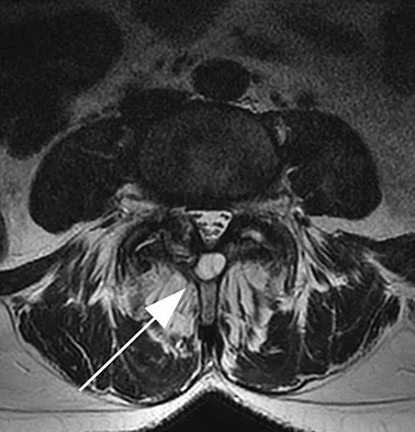 General Orthopedics 2026 Practice Questions: Set 9 (Solved) - Figure 26