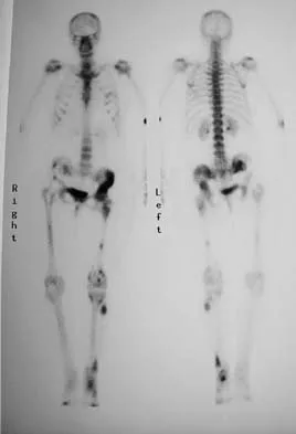 General Orthopedics 2026 Practice Questions: Set 9 (Solved) - Figure 29