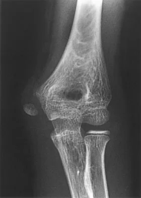 General Orthopedics 2026 Practice Questions: Set 9 (Solved) - Figure 3