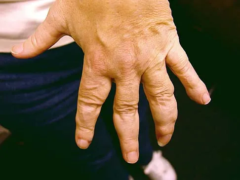 General Orthopedics 2026 Practice Questions: Set 9 (Solved) - Figure 31