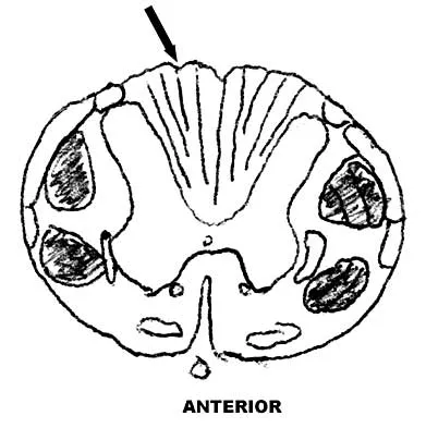 General Orthopedics 2026 Practice Questions: Set 9 (Solved) - Figure 35