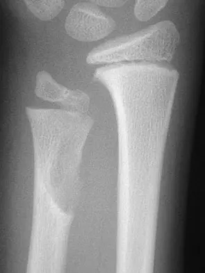 General Orthopedics 2026 Practice Questions: Set 9 (Solved) - Figure 38