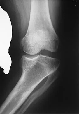 General Orthopedics 2026 Practice Questions: Set 9 (Solved) - Figure 4