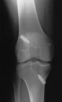 General Orthopedics 2026 Practice Questions: Set 9 (Solved) - Figure 44