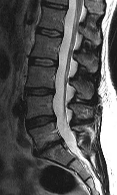 General Orthopedics 2026 Practice Questions: Set 9 (Solved) - Figure 45