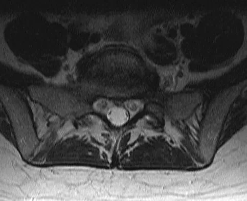 General Orthopedics 2026 Practice Questions: Set 9 (Solved) - Figure 46