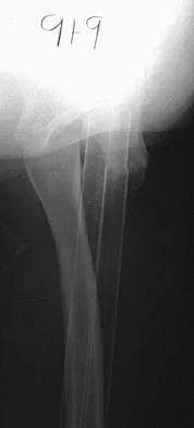 General Orthopedics 2026 Practice Questions: Set 9 (Solved) - Figure 52