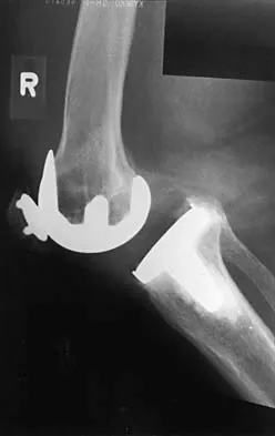 General Orthopedics 2026 Practice Questions: Set 9 (Solved) - Figure 57