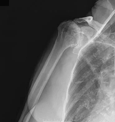 General Orthopedics 2026 Practice Questions: Set 9 (Solved) - Figure 58