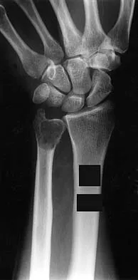 General Orthopedics 2026 Practice Questions: Set 9 (Solved) - Figure 60