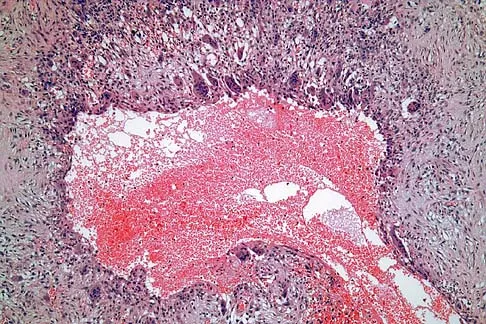 General Orthopedics 2026 Practice Questions: Set 9 (Solved) - Figure 61