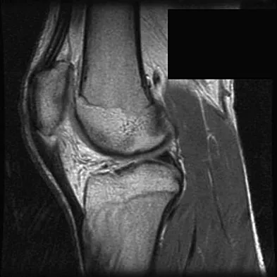 General Orthopedics 2026 Practice Questions: Set 9 (Solved) - Figure 63