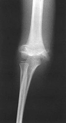 General Orthopedics 2026 Practice Questions: Set 9 (Solved) - Figure 64