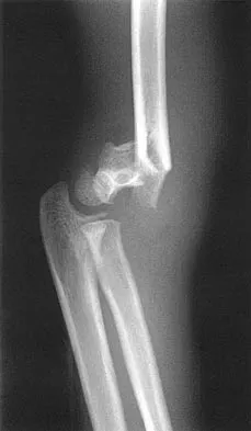 General Orthopedics 2026 Practice Questions: Set 9 (Solved) - Figure 65