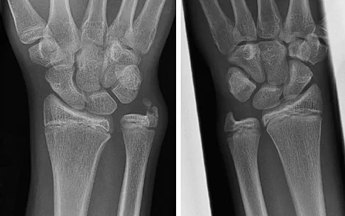 General Orthopedics 2026 Practice Questions: Set 9 (Solved) - Figure 7