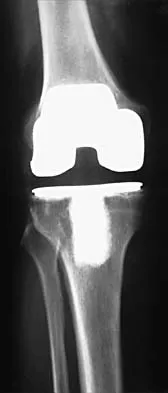 General Orthopedics 2026 Practice Questions: Set 9 (Solved) - Figure 71