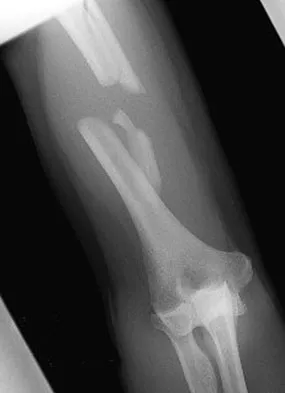 General Orthopedics 2026 Practice Questions: Set 9 (Solved) - Figure 74