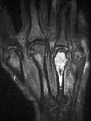 General Orthopedics 2026 Practice Questions: Set 9 (Solved) - Figure 77