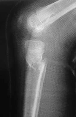 General Orthopedics 2026 Practice Questions: Set 9 (Solved) - Figure 79