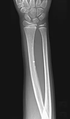 Click to enlarge General Orthopedics 2026 Practice Questions: Set 9 (Solved) - Figure 80