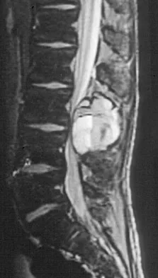General Orthopedics 2026 Practice Questions: Set 9 (Solved) - Figure 82