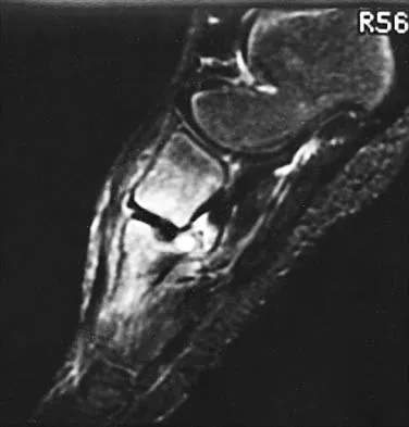 General Orthopedics 2026 Practice Questions: Set 9 (Solved) - Figure 92
