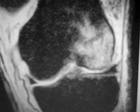 General Orthopedics 2026 Practice Questions: Set 9 (Solved) - Figure 93