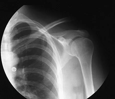 General Orthopedics 2026 Practice Questions: Set 9 (Solved) - Figure 96