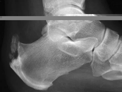 General Orthopedics Board Review 2026: High-Yield MCQs (Set 18) Figure 1