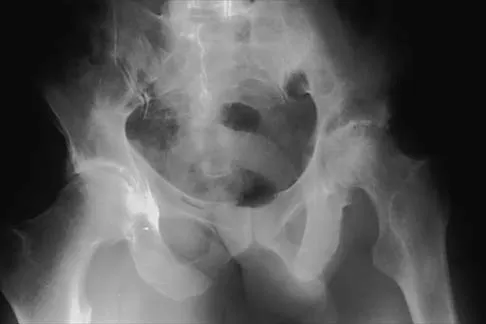 Hip 2001 Practice Questions: Set 1 (Solved) - Figure 15